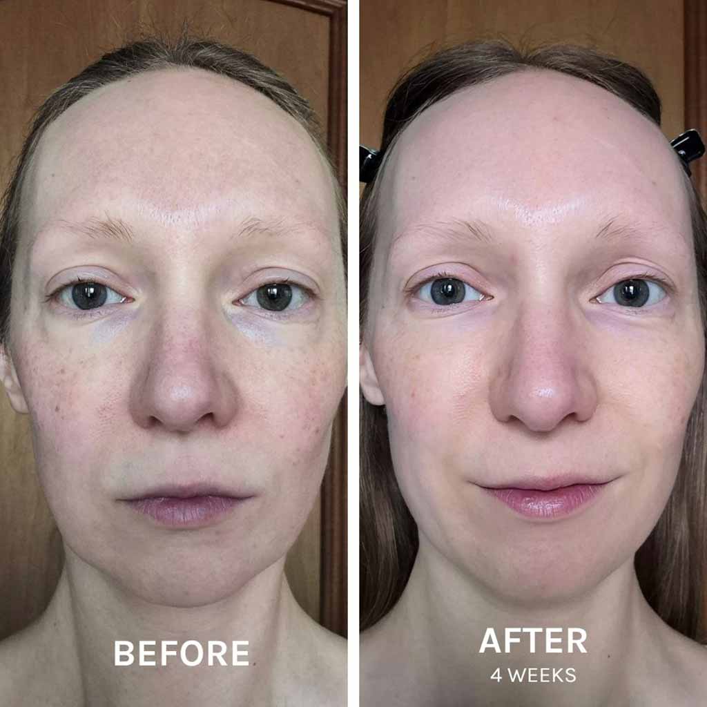 Evolve Organic Beauty EGF + Collagen Renewal Booster 15ml