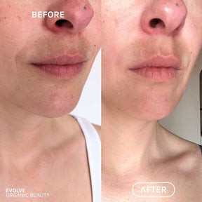 Evolve Organic Beauty Resveratrol + Niacinamide Serum 30ml