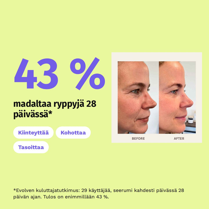 Evolve Organic Beauty Age Defying Lifting Serum 10ml matkakoko. 43 % madaltaa ryppyjä 28 päivässä*. Kiinteyttää. Kohottaa. Tasoittaa. *Evolven kuluttajatutkimus: 29 käyttäjää, seerumi kahdesti päivässä 28 päivän ajan. Tulos on enimmillään 43 %.
