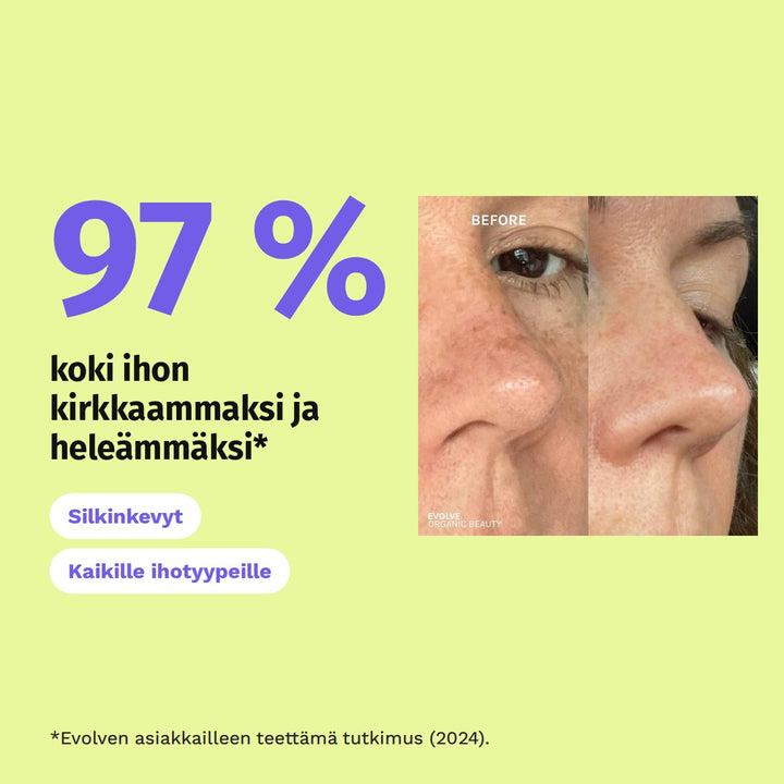 Evolve Resveratrol + Niacinamide Serum 30 ml: 97 % koki ihon kirkkaammaksi ja heleämmäksi*. *Evolven asiakkailleen teettämä tutkimus (2024).